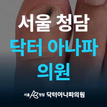 서울 청담 닥터 아나파의원